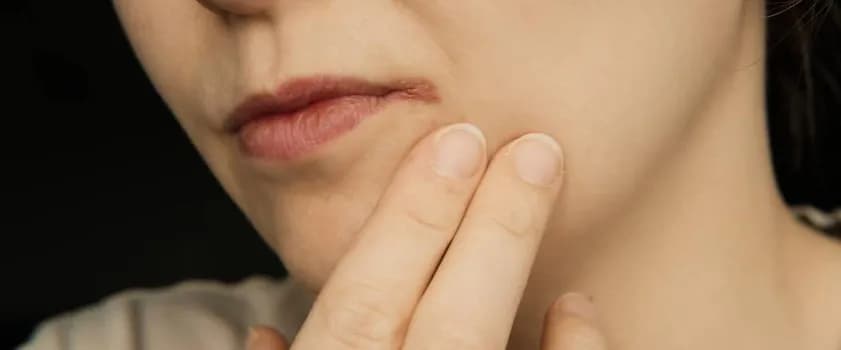 Skuteczne leki na zajady: jak szybko pozbyć się problemu z ustami