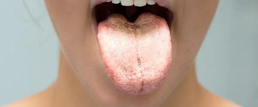 Skuteczne leki na grzyby w organizmie - uniknij nieprzyjemnych objawów